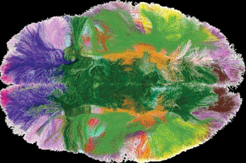 Image: Rendering of long white matter fiber bundles (Photo courtesy of CONNECT Consortium).